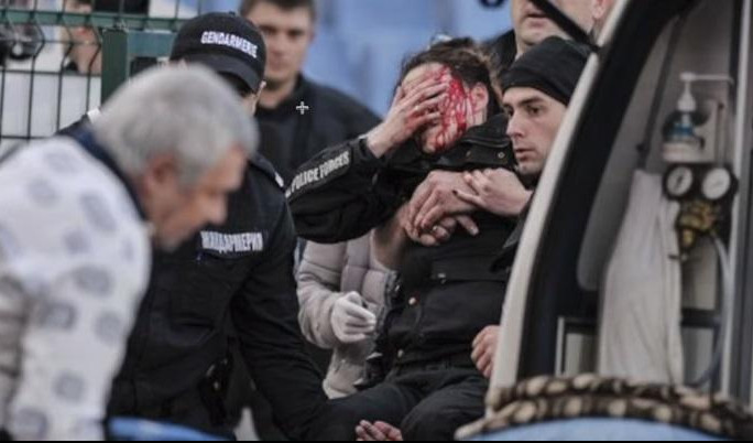 (VIDEO) BUGARI SU GORI OD NAS! Eksplodirala bomba pred utakmicu, teško povređena policajka!