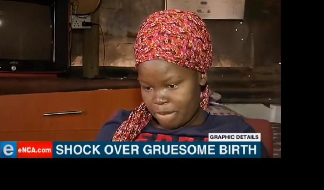 (VIDEO) HOROR NA POROĐAJU! Izašla je samo bebina glava, telo je ostalo unutra!