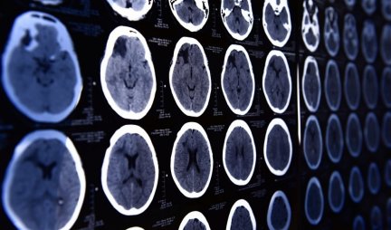ŠOKANTAN TEST ČUVENOG PROFESORA NEUROLOGIJE! Otkrijte koliko je star vaš mozak i kako radi
