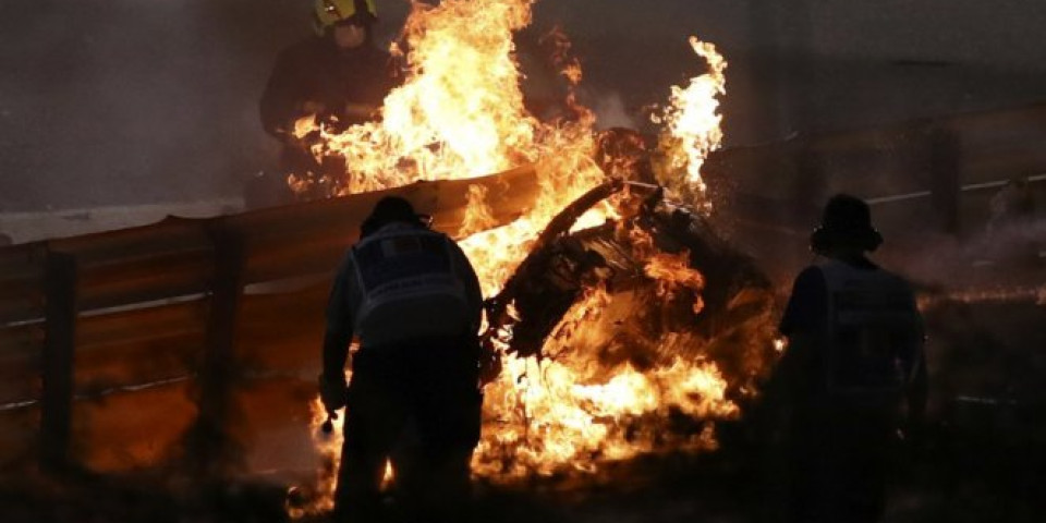(FOTO) SKORO ZAPLAKAO! Ovako izgleda Grožanova ruka posle vatre!