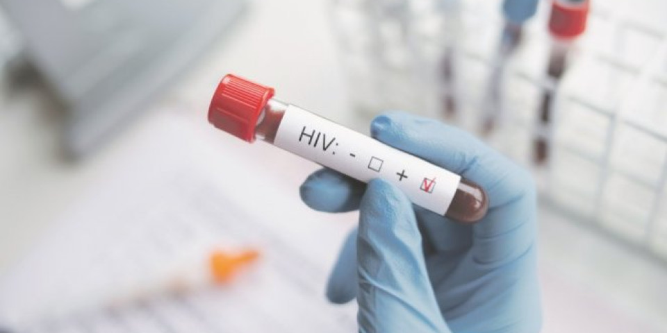 MLADI LJUDI OBOLEVAJU I UMIRU, A MI IMAMO SAVREMENU TERAPIJU! Besplatno testiranje na HIV u Gradskom zavodu za javno zdravlje