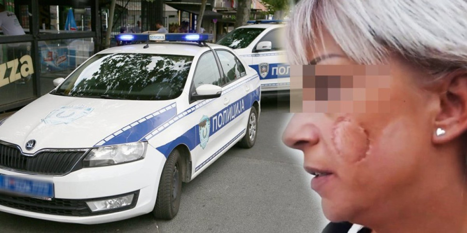 Ugrizao ženu nasred ulice i sada ide na robiju! Epilog drame u Sremskoj Mitrovici (UZNEMIRUJUĆI VIDEO)