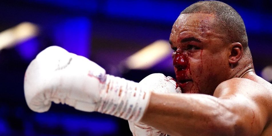 Krv šiklja, majka ga neće prepoznati... Brutalan boks u Londonu (VIDEO/FOTO)