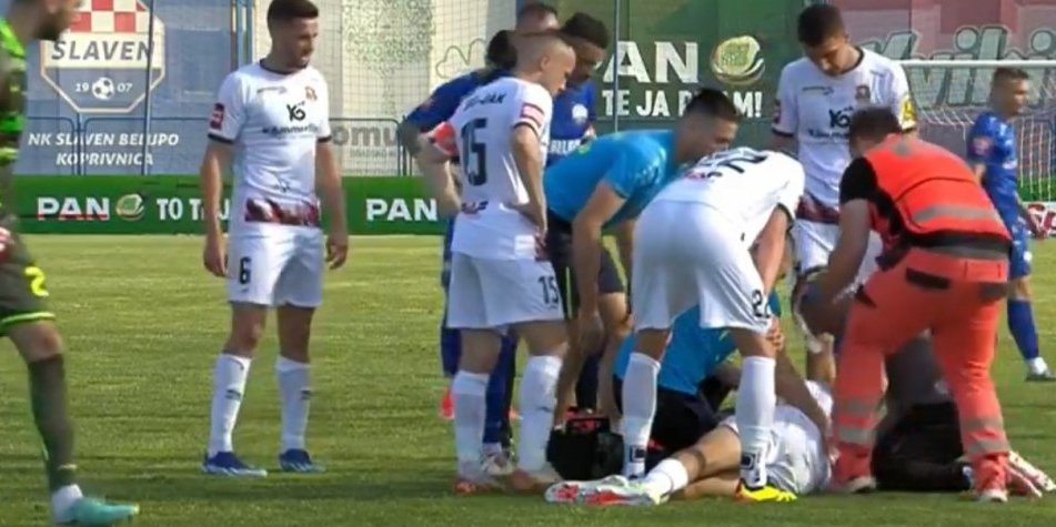 Jezivo! Ovako izgleda srpski fudbaler koji je dobio koleno u glavu! (FOTO/VIDEO)