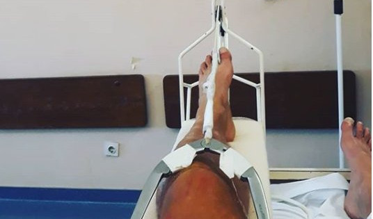 (FOTO) STRAŠNO! OVAKO IZGLEDA POVREDA MIKIJA ĐURIČIĆA! Fiksirali mu nogu, ostaje u bolnici na lečenju!