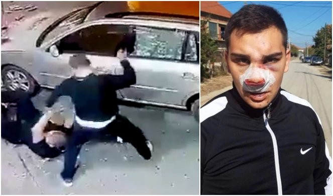 SLOMIŠ ČAŠU, A ONI TI SLOME SVA REBRA! Brutalna tuča u Vranju ŠOKIRALA JE SRBIJU, a Nemanja sada otkriva detalje: GUBIO SAM SVEST KOLIKO SU ME TUKLI