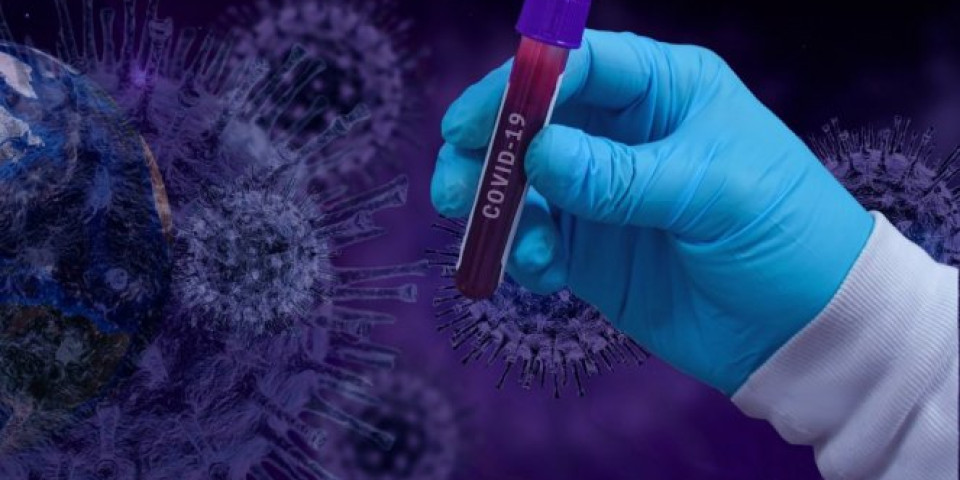 U AFRICI SE ŠIRI TALAS PANDEMIJE! Potvrđeno skoro 445.000 slučajeva koronavirusa!