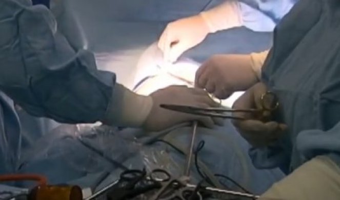 (VIDEO) PRVI PUT U REGIONU! U KC Kragujevac urađena operacija tumora plućnog krila NA POTPUNO NOV NAČIN!