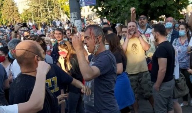 (VIDEO) SERGEJU NA PROTESTU ĐILASOVACA RAZBILI GLAVU! Lider PSG brutalno napadnut ispred Skupštine Srbije