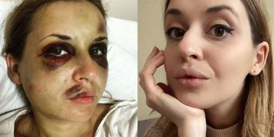 VODITELJKA JEDVA IZBEGLA SILOVANJE! Drama u vozu! Brutalan napad na ukrajinsku lepoticu! (VIDEO)