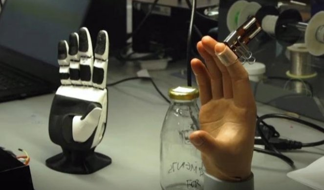 REVOLUCIONARNO! Veštačka koža omogućava ljudima sa protezom da ponovo osete TOPLOTU I BOL (VIDEO)