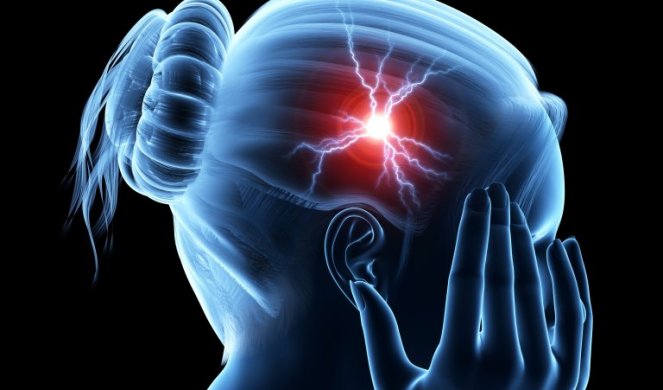 NA PRVI POGLED BEZAZLENE PROMENE, A U STVARI MOGU BITI ZNAK ZA ALARMANTNU UZBUNU! Rak mozga ima ovih šest simptoma