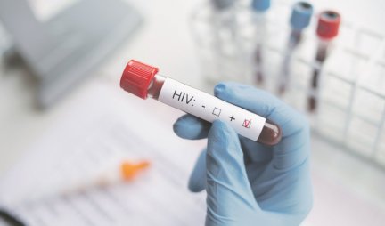 PACIJENTKINJA SA LEUKEMIJOM PRVA ŽENA IZLEČENA OD HIV-A!