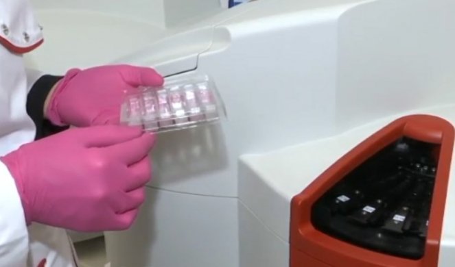 USKORO JOŠ JEDAN SRPSKI TEST NA KORONAVIRUS! Za DVA SATA se mogu dobiti rezultati za čak 30 uzoraka krvi! (Video)