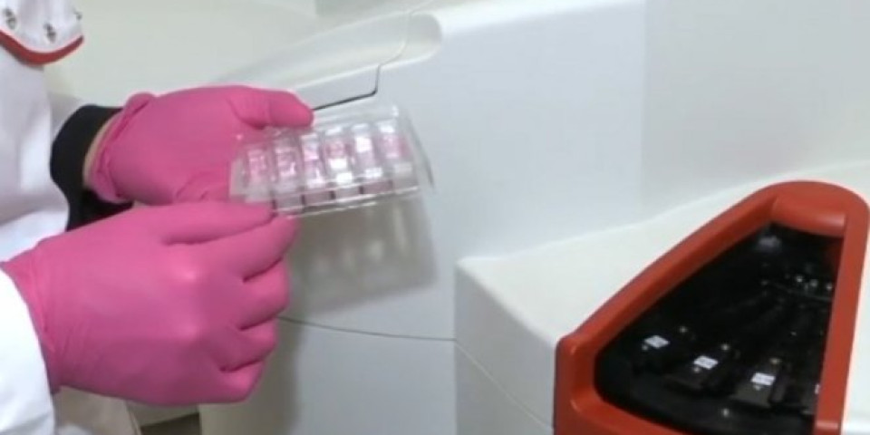 USKORO JOŠ JEDAN SRPSKI TEST NA KORONAVIRUS! Za DVA SATA se mogu dobiti rezultati za čak 30 uzoraka krvi! (Video)
