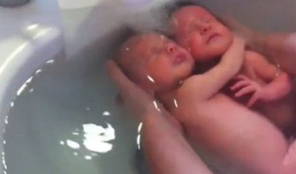 Ovo su blizanci koji su zapanjili svet nakon rođenja: Pogledajte i zbog čega /VIDEO/