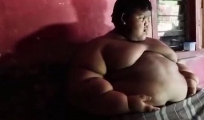 SA SAMO DESET GODINA JE TEŽIO 192 KILOGRAMA! Ovaj dečak je bio NAJDEBLJI NA SVETU, a onda se desilo ČUDO! /FOTO/VIDEO/