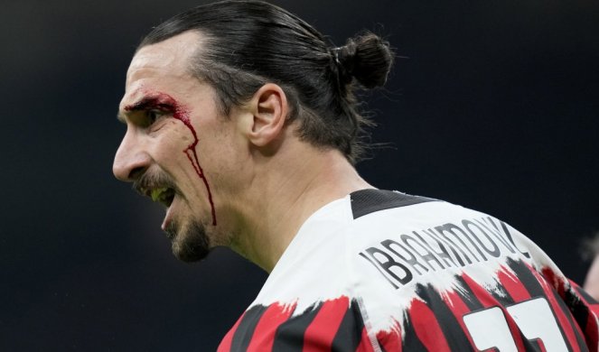 UŽASNE SCENE! Ibrahimović s krvavom glavom na terenu! (FOTO)