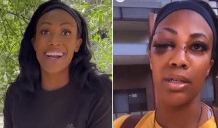 PRETUČENA ODBOJKAŠICA NASRED ULICE! Beskućnik je tukao, naneo joj teške povrede! (VIDEO)