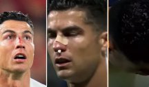 ŠOKANTNA SCENA, KRV ŠIKLJALA NA SVE STRANE! Krvavi Ronaldo nije znao šta ga je snašlo, a onda je jednim potezom sve zabezeknuo! (VIDEO/FOTO)