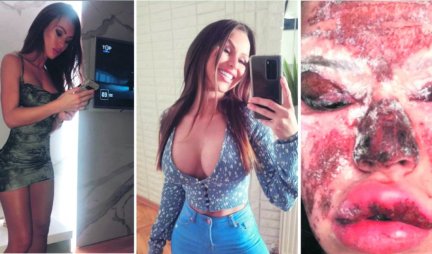 Barbi nadrilekarka ponovo radi: Olgici se sudi da je unakazila lica 18 žena, "ulepšavanje" nastavila u drugom salonu