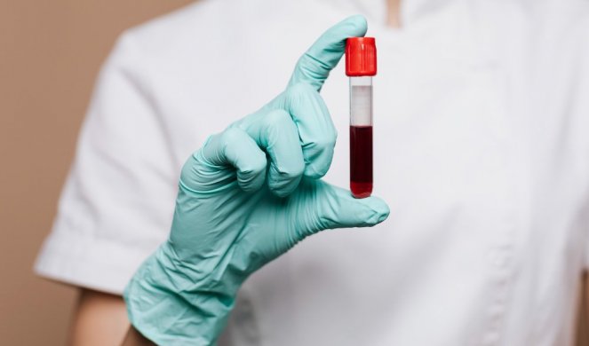 Novi test krvi može da pokaže koliko brzo nam stare unutrašnji organi!