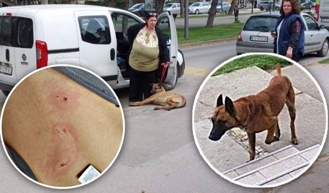 BELGIJSKI OVČARI NAPALI PETORO DECE U SUBOTICI! Jedno dete ugrizli za uvo u dvorištu vrtića RODITELJI OČAJNI (FOTO)