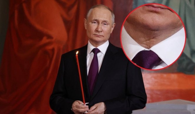 SVET U ČUDU - ŠTA JE SA PUTINOM?! Nova fotografija ruskog lidera obišla planetu! "Pogledajte mu vrat..."