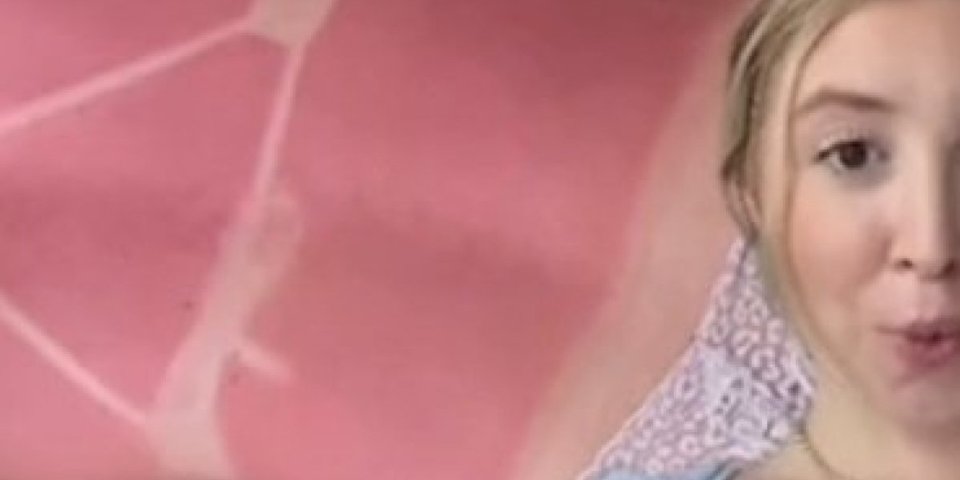 Izgorela sam, a bilo je oblačno! Devojka podelila jezive slike - nakon sunčanja završila u bolnici (VIDEO)