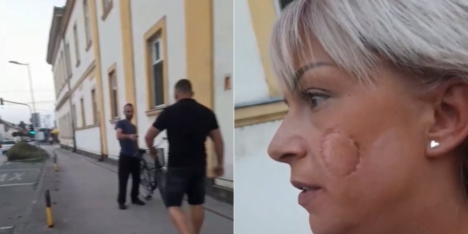 "Kad ju je ugrizao za obraz, mislila sam da će joj odgristi meso"! Ispovest žene koja je spasila Mitrovčanku (34) od bivšeg supruga (FOTO/VIDEO)