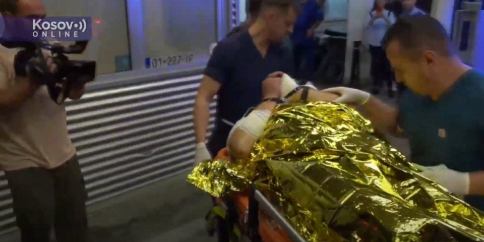Snimak iz bolnice! Ranjeni Srbin iz Banjske ima prostrelne rane i prelom (VIDEO)