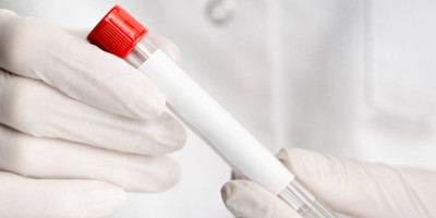 Umesto da neplodnost bude osnovni razlog zbog kojeg se parovi odlučuju na veštačku oplodnju, naučnici idu korak dalje i predlažu da se bira "najzdraviji" ebrion.