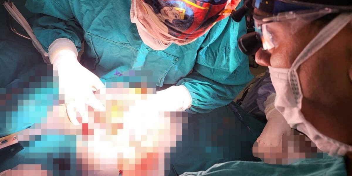 Neverovatan podvig kardiohirurga u KC Srbija! Čoveku ugradili dve srčane pumpe u isto vreme