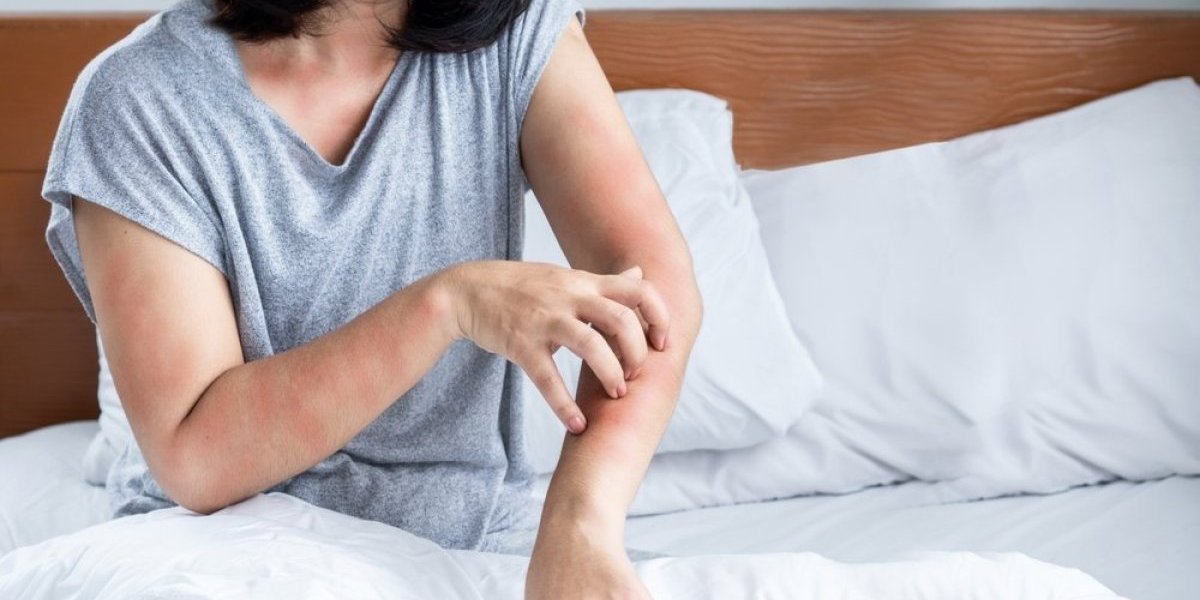 Svrab kože ukazuje na bolest bubrega: Obratite pažnju na simptome i potražite pomoć na vreme