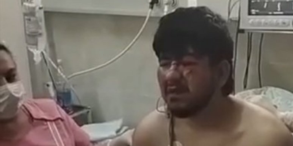 Objavljen snimak teroriste u bolnici! Sav krvav, vezanih ruku priključen na aparate (VIDEO)
