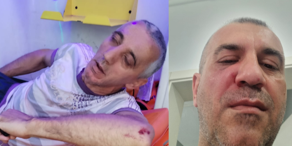 "Pukla mi je jagodična kost, ležim u bolnici" Evo u kakvom je stanju Vladimir Kostić koga su zverski pretukli huligani iz opozicije! (VIDEO)