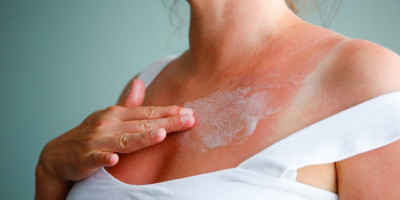 Prema podacima Instituta za javno zdravlje "Dr Milan Jovanović Batut" u Srbiji godišnje više od sedam hiljada ljudi oboli od raka kože, od toga od melanoma 700. Nažalost, od ovog broja 200 ljudi izgubi bitku sa tom opakom bolešću, pokazuju podaci Instituta za javno zdravlje "Dr Milan Jovanović Batut".