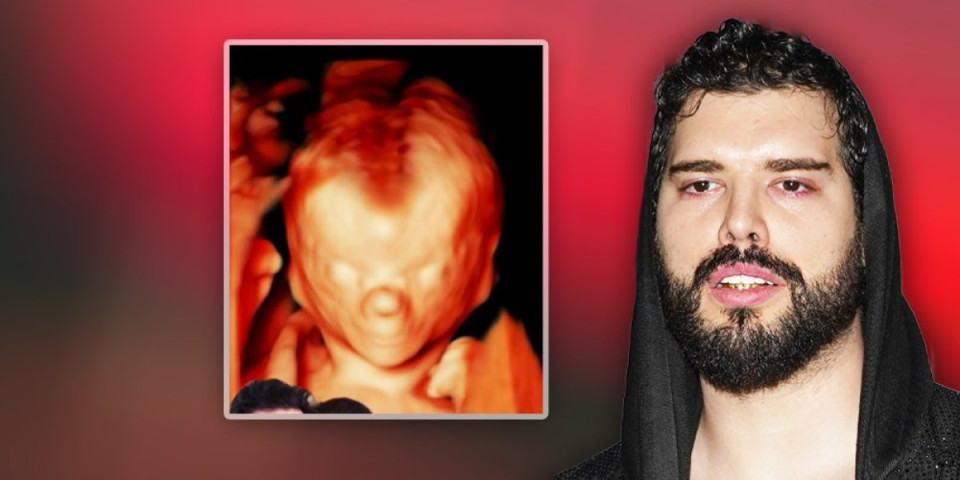 Samozvani "bog obrva" pokazao nerođeno dete! Adaktar podelio snimak ultrazvuka, pa sve nasmejao: "Imamo noja!" (VIDEO)