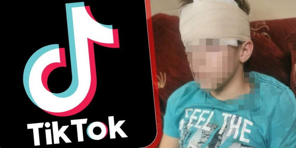 Dečak iz Pančeva umalo nastradao zbog Tiktok izazova: Tražio da mu drug obmota glavu streč folijom i da ga snima, onesvestio se i pao (FOTO)