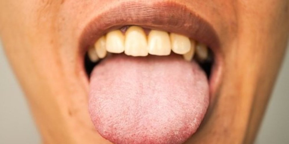 Tri simptoma u ustima su znaci upozorenja na ozbiljan nedostatak!