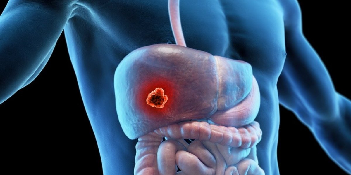 6 neobičnih simptoma bolesne jetre - Jedan možete da primetite na licu