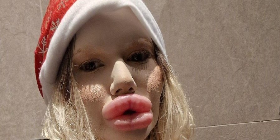 Žena sa najvećim ustima na svetu se ne zaustavlja! Ovog Božića planira da ugradi još jedan filer u usne, ali to nije sve (FOTO)