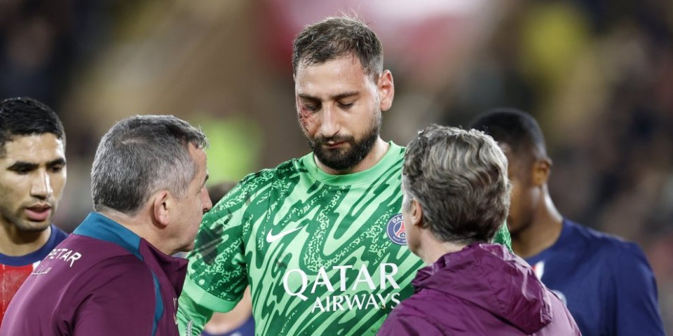 Oglasio se Donaruma! Evo kako izgleda nakon što mu je lice unakaženo! (FOTO)