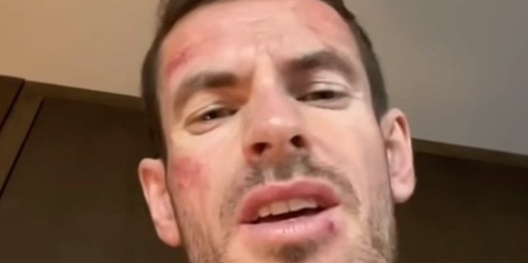 Šok! Endi Marej u ranama i modricama: Muka mi je, ostavite me na miru... (VIDEO)