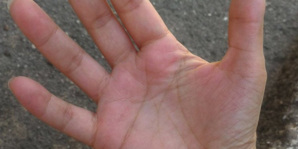 Veruje se već vekovima:  Ako vas svrbi leva ruka – dolazi novac, a evo šta znači ostalo