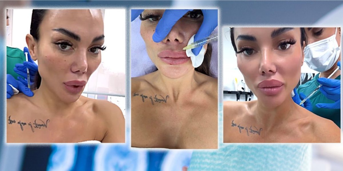 Blokirala mišić da joj vrat izgleda duže: Tamara Đurić spremna na sve zbog lepote