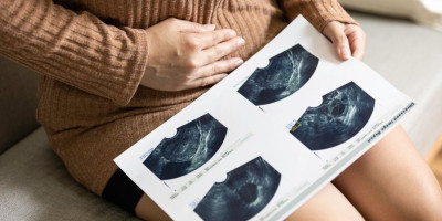 Nova studija koja je analizirala preko dva miliona slučajeva, pokazuje drastičan porast "ranog raka" najviše kod dojke, debelog creva, bubrega i materice, sa skokom od čak 80% između 2010. i 2019. godine.