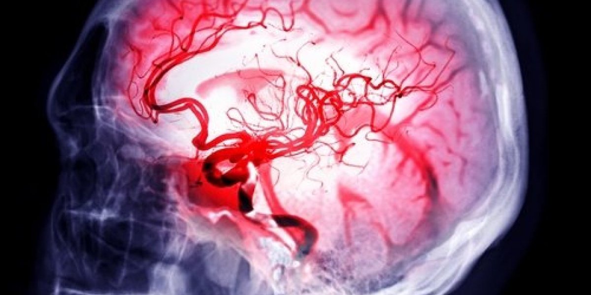 Test od 30 sekundi otkriva tumor mozga! Ako ne možete da uradite ovo, idite kod lekara odmah (VIDEO)