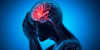 Aneurizma u mozgu je ozbiljno stanje koje ponekad može da prođe potpuno nezapaženo dok ne dođe do iznenadne, potencijalno smrtonosne rupture.