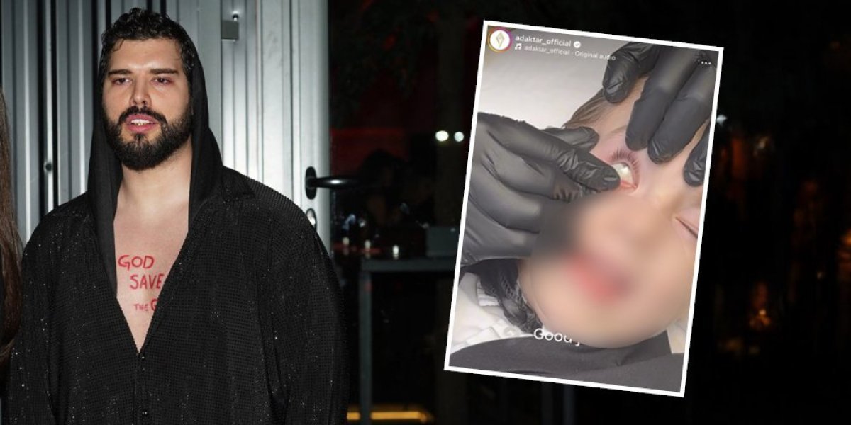 Adam šokirao javnost! Adaktar svom četvorogišnjem sinu stavio sočiva